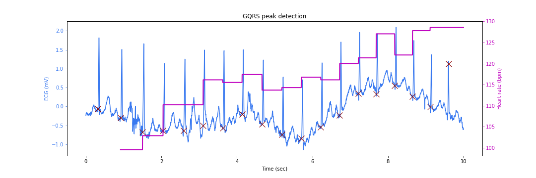 ECG instantaneous heart rate