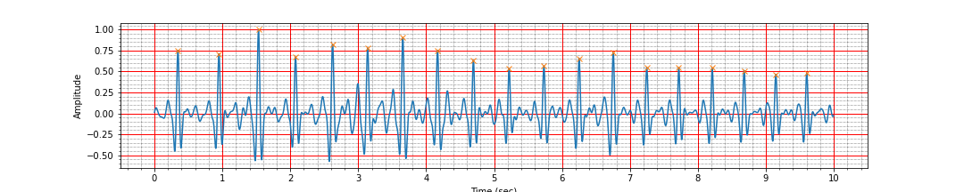 ECG peaks after band pass filtering