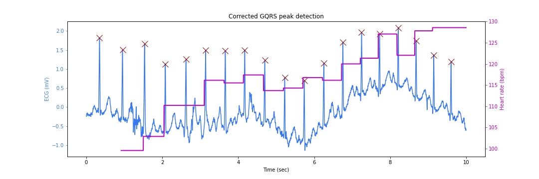 ECG corrected peaks