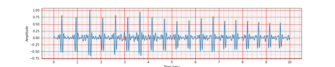ECG peaks after derivative filtering
