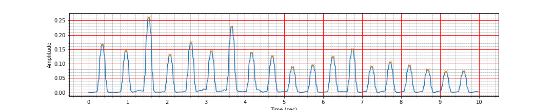 ECG peaks after moving average