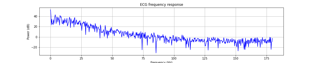ECG spectrum