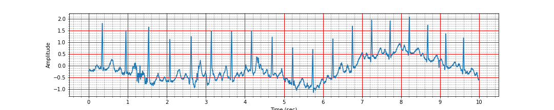 ECG strip